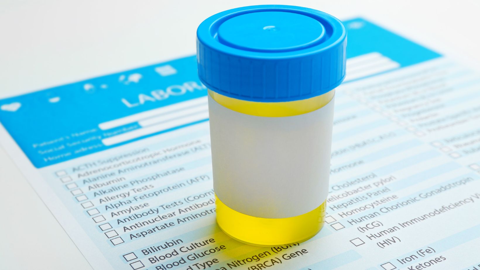 How Can You Tell the Difference Between Male and Female Urine Samples