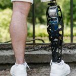 The Role of 3D Printing in Custom Prosthetics and Bionic Limbs